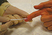 Fingerprick for blood taking